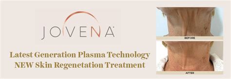 Jovena Skin Rejuvenation Dr Rita Rakus London