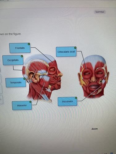 Ch Assignment The Muscular System Flashcards Quizlet