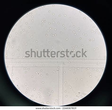 18 Urine Microscopic Examination Wbc Images, Stock Photos & Vectors ...