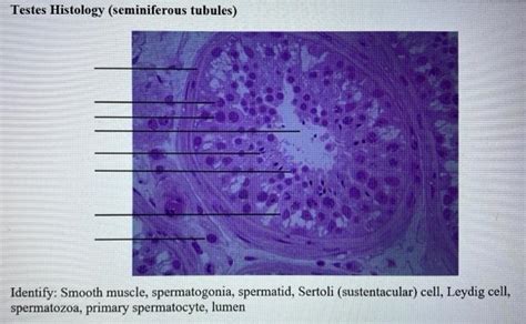 Solved Testes Histology (seminiferous tubules) Identify: | Chegg.com 