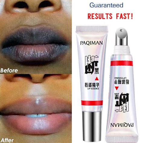 Lips Pink Fresh Lightening Bleaching Cream Remove Dark Smoke Lips Lip