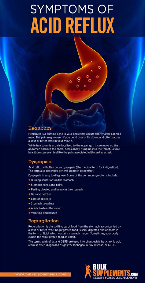 Acid Reflux and Gerd: Diet, Medicine and Remedy