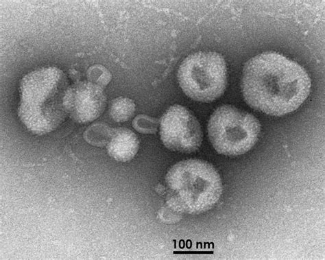 Bolivian Machupo hemorrhagic fever: causes, symptoms and treatment ...