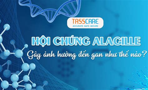 Hội Chứng Alagille Gây ảnh Hưởng đến Gan Như Thế Nào Trung Tâm Xét