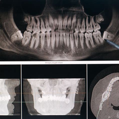 Panoramic X Ray Dental Clinic In Dubai