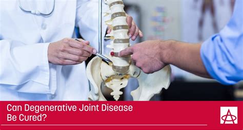 Is There A Cure For Degenerative Joint Disease