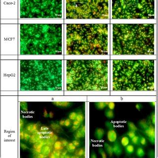 Fig S The Dna Fragmentation By Tunel Assay In Caco Cell Line The