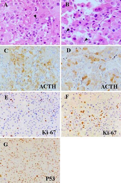 Photomicrographs Of The Histological And Immunohistochemical Features