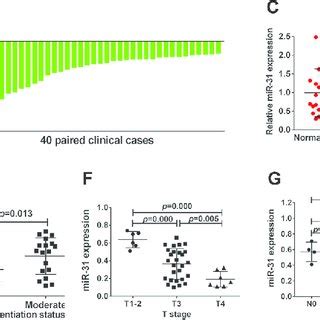 Downregulation Of Mir 31 Expression In Gastric Cancer Cell Lines And