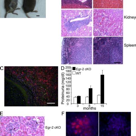 Development Of Lupuslike Autoimmunity In Older Egr Cko Mice A Skin