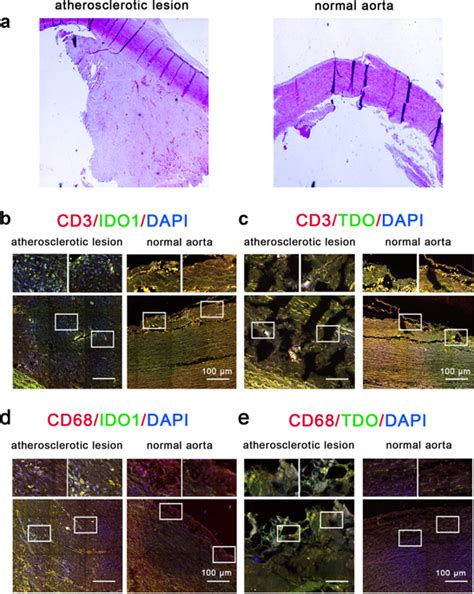 The Proatherosclerotic Function Of Indoleamine Dioxygenase In