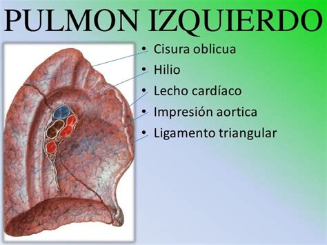 Pulmón Izquierdo Notese el marcado del Callao y la Aorta Descendente