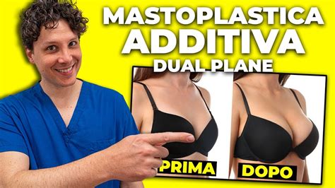 Mastoplastica Additiva Dual Plane Intervento Di Sephora Youtube