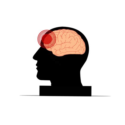 Headache And Brain Trauma 16390610 PNG