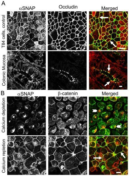 A Dual Immunofluorescence Labeling And Confocal Microscopy Show