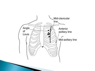 Thoracostomy indications and options