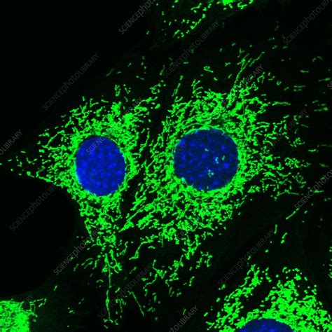 Cancer Associated Fibroblasts Confocal Light Micrograph Stock Image C045 7071 Science