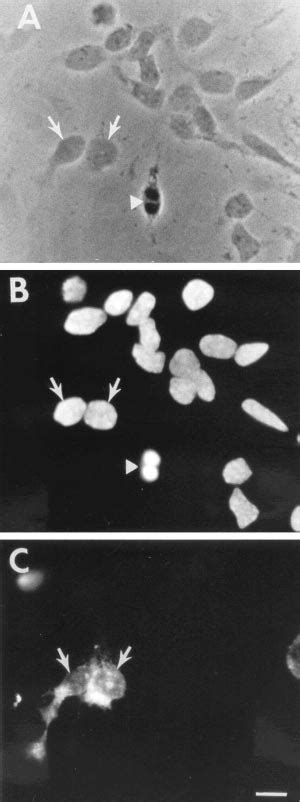 Symmetric Divisions In Progenitor Cells Phase A And Fluorescence Download Scientific Diagram