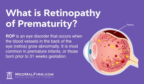 What Is Retinopathy Of Prematurity MedMalFirm