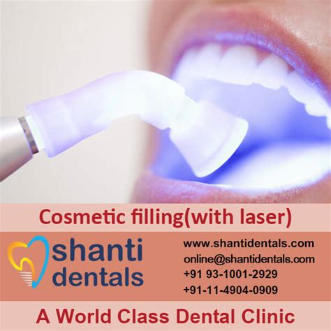 Improve The Appearance Of Teeth With Cosmetic Filling With Laser In