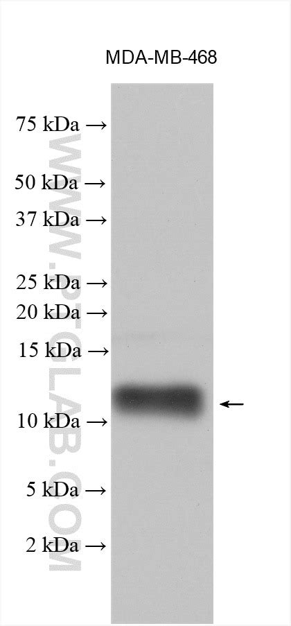 S100a7psoriasin Antibody 26656 1 Ap Proteintech