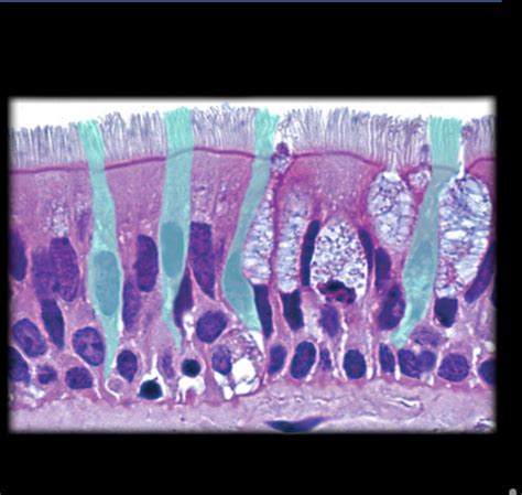 Apr Assignment Respiratory Histology Flashcards Quizlet