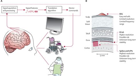 Braincomputer Interfaces In Neurological Rehabilitation The Lancet