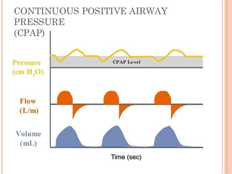 Basic Ventilatory Modes