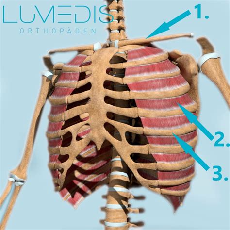 Bilder von Wirbelsäulenerkrankungen Lumedis Ihre Orthopäden