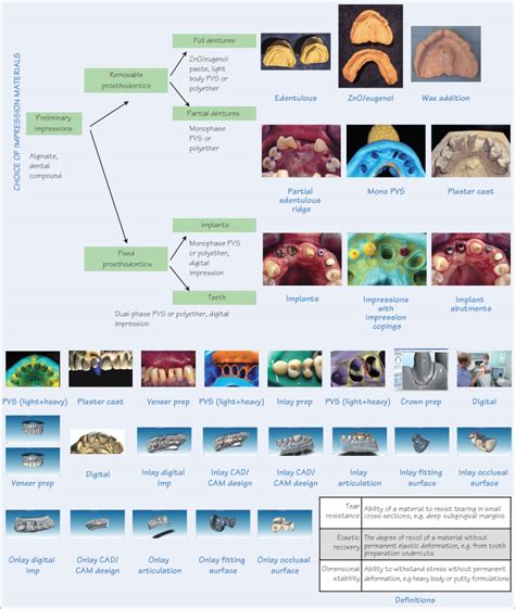 39 Impression materials | Pocket Dentistry