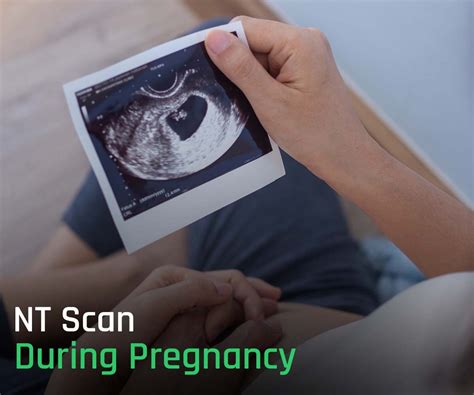 A Comprehensive Guide About Nt Scan During Pregnancy In 2023