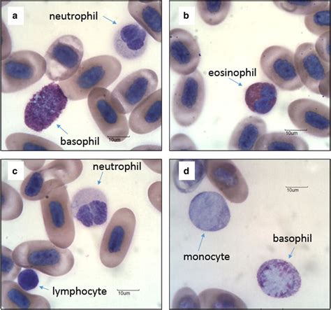 Leukocytes