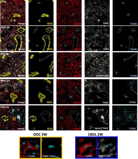 Kupffer Cells Contested As Early Drivers In The Pathogenesis Of Primary