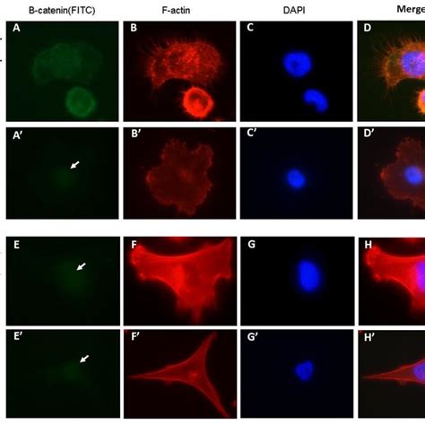 Antibody Labeling Of ß Catenin And F Actin In Mda Mb 231 Cells And Download Scientific Diagram