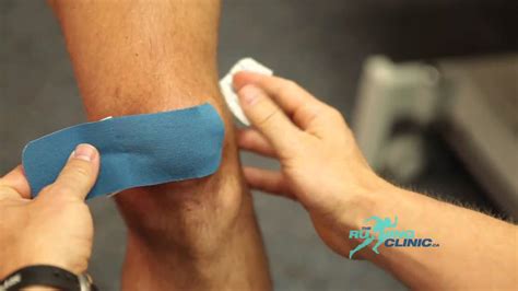 Taping Patellofemoral Pain Syndrome Youtube