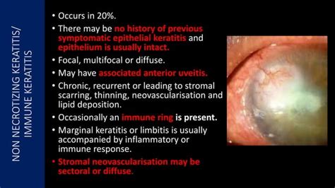 Viral Keratitis: Diagnosis, Management and Latest Guidelines | PPT