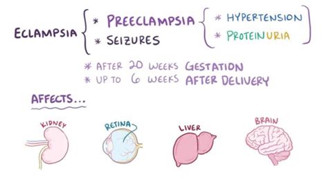 Gestational Hypertension Exams Naxlex Nursing