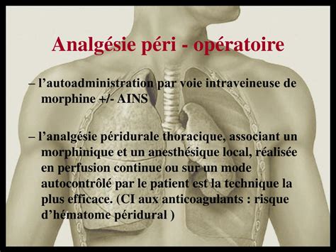 Ppt Traitement Chirurgical Du Pneumothorax Spontan Powerpoint