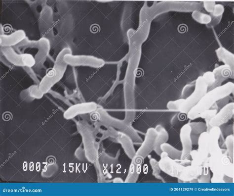 Scanning Electron Microscope Photo of Vibrio Bacteria X12000 Stock ...