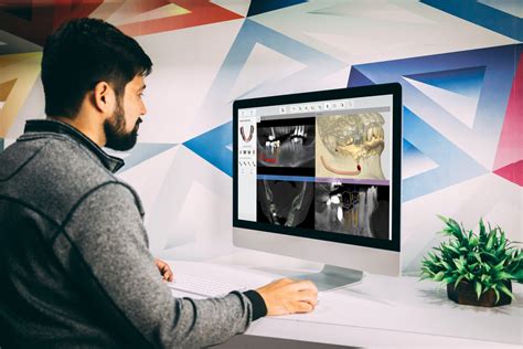 Implant Planning Software Review For Guided Implant Surgery Conescan