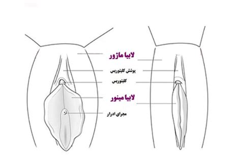 علت تغییر شکل لبه‌های واژن و بزرگ شدن لابیاها چیست؟