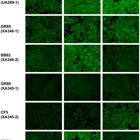 Ana Indirect Immunofluorescence Examples Of Immunofluorescent Staining