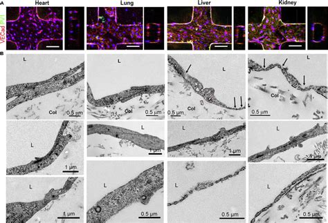 Ultrastructural Heterogeneity Of Human Fetal ECs Upon In Vitro