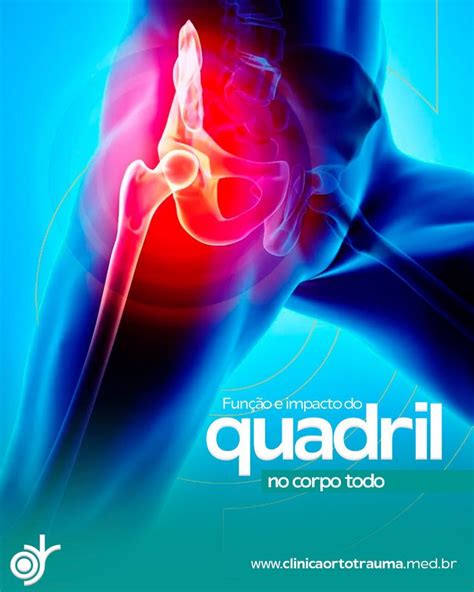 Fun O E Impacto Do Quadril No Corpo Todo Ortotrauma