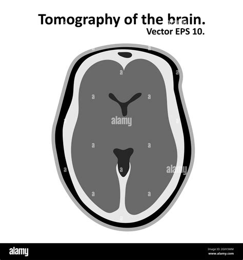 Magnetic Resonance Imaging Of The Brain Cross Section Of The Brain