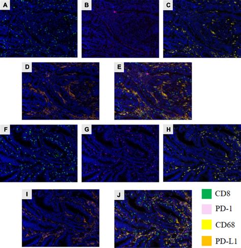 Assessment Of The Time Via Multiplex Ihc Mihc A And F The Green