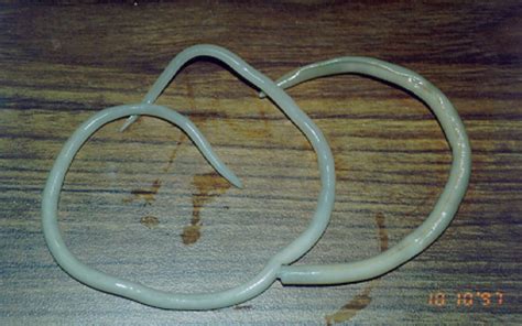 File:Ascaris lumbricoides adult worms.png - Wikimedia Commons