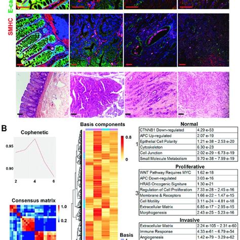 Rna Seq Analysis Clusters The Tumors Into Two Major Download