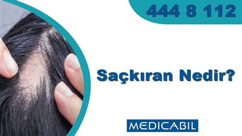 Blog Sa K Ran Alopesi Areata Nedir