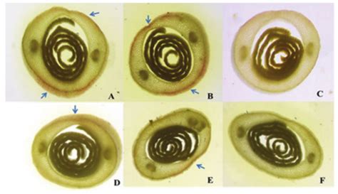 Scielo Brasil Primary Leaf Growth And Coleoptile Length In Maize